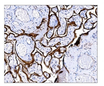 Arylsulfatase C Antibody / Steryl-sulfatase / ARSC