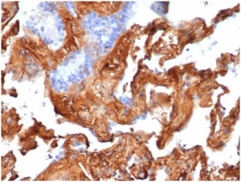 Fibronectin 1 Antibody / FN1