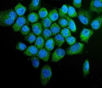 PINK1 Antibody / PARK6