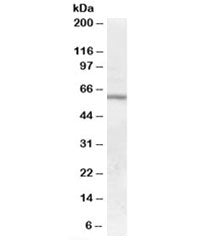 Western blot testing of human bone marrow lysate with GALNS antibody at 0.01ug/ml. Predicted molecul