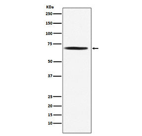 Western blot testing of human Jurkat cell lysate with PDC-E2 antibody. Predicted molecular weight ~6