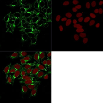 Immunofluorescent staining of permeabilized human HeLa cells with Clathrin Heavy Chain antibody (clo