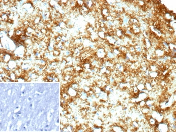 IHC staining of FFPE human brain tissue with MBP antibody (clone rMBP/9431). Inset: PBS used in plac