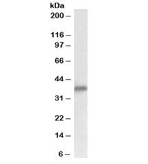 Western blot testing of human heart lysate with delta-Sarcoglycan antibody at 0.1ug/ml. Predicted mo