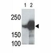 LRP5 antibody used in western blot to detect recombinant human LRP5 (Lane 1) and mouse LRP5 (2) prot