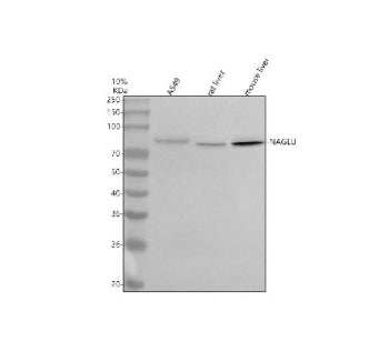 Western blot analysis of NAGLU using anti-NAGLU antibody. Lane 1: human whole cell lysates, Lane 2: 