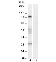 Western blot testing of human brain lysate with Nogo 66 receptor antibody at 0.3ug/ml with [B] and w