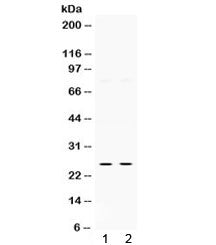 Thymidine kinase 1 Antibody