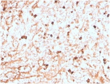Lambda Light Chain Antibody