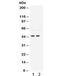 Western blot testing of 1) rat brain and 2) rat lung lysate with PAX2 antibody. Expected/observed mo