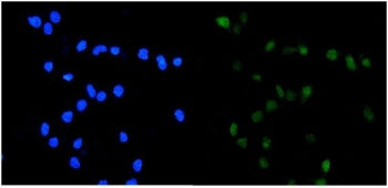 IF/ICC staining of FFPE human U-2 OS cells with TOP2A antibody (green) at 2ug/ml and DAPI nuclear st