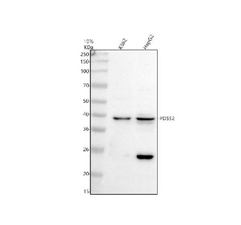 PDSS2 Antibody / Prenyl diphosphate synthase subunit 2, 100ug