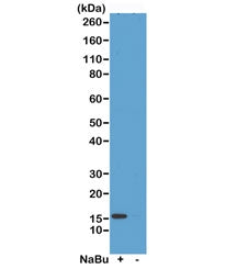 Western blot test of acid extracts from HeLa cells treated (+) or untreated (-) with sodium butyrate