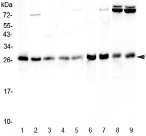 Western blot testing of human 1) HeLa, 2) Jurkat, 3) MCF7, 4) HepG2, 5) A549, 6) rat stomach, 7) rat