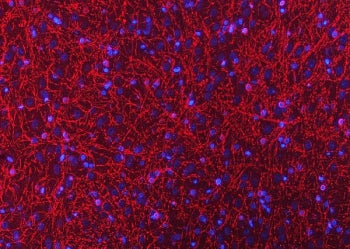 CNPase Antibody / CNP