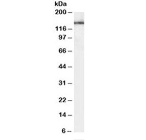 Western blot testing of human brain lysate with Leptin Receptor antibody at 1ug/ml. Predicted molecu
