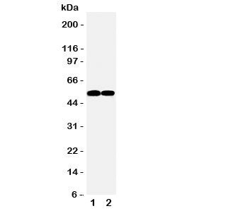 Western blot testing of FLI1 antibody and Lane 1: Jurkat; 2: Raji cell lysate. Predicted/observed mo