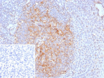 IHC staining of FFPE human tonsil tissue with CD35 antibody (clone CR1/8223R). Inset: PBS used in pl
