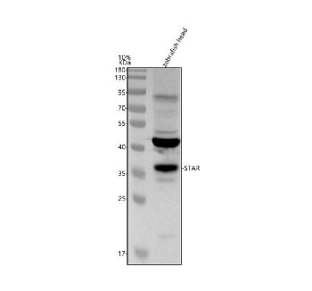 Western blot analysis of Star protein using Zebrafish Star antibody and zebrafish head tissue lysate