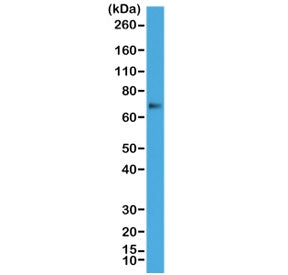 Western blot test of human A431 cell lysate with recombinant p63 antibody at 1:1000. Expected molecu