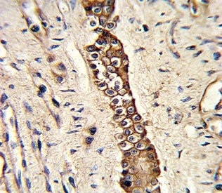 DDR2 Antibody