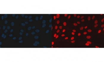 BAF57 Antibody / BRG1-associated factor 57 / SMARCE1