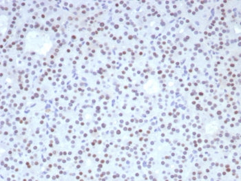 IHC staining of FFPE human parathyroid tissue with Forkhead box protein L2 antibody (clone FOXL2/836