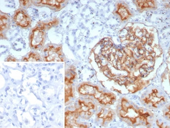 IHC staining of FFPE human prostate tissue with recombinant MME antibody (clone rMME/9377). Inset: P