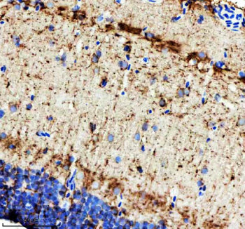 IHC staining of FFPE zebrafish brain tissue with Zebrafish ILK antibody. HIER: boil tissue sections 