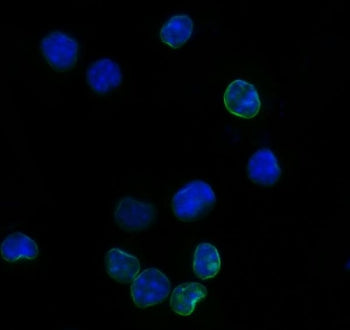 Cd25 Antibody / IL2ra