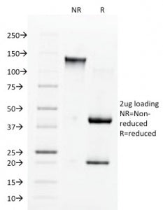 SDS-PAGE analysis of purified, BSA-free Angiotensin Converting Enzyme antibody (clone 9B9) as confir