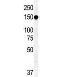 MRP7 Antibody / ABCC10