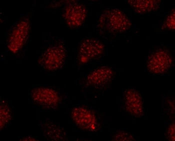 Immunofluorescent staining of FFPE human U-2 OS cells with SOX10 antibody (red). HIER: steam section