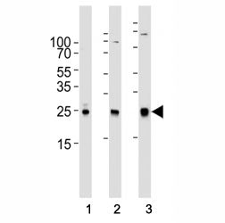 Western blot analysis of lysate from (1) human A431, (2) mouse NIH3T3, (3) rat C6 cell line using RA