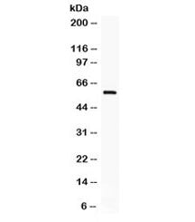 IKAROS Antibody / IKZF1