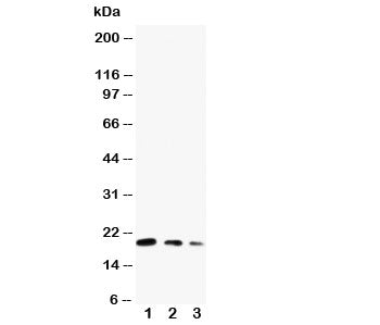 Western blot testing of CDC42 antibody and Lane 1: ecombinant human protein 10ng; 2: 5ng; 3: 2.5ng
