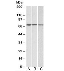 Western blot testing of A) Daudi, B) Jurkat and C) K562 lysates with OAS2 antibody at 0.3ug/ml. Pred