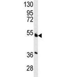 Western blot analysis of HNF4A antibody and NCI-H460 lysate. Predicted molecular weight ~50 kDa.