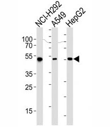 ALDH2 Antibody, 0.4ml