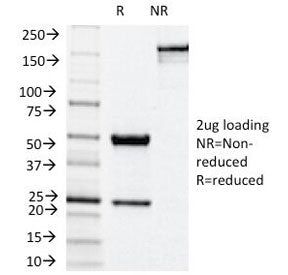 NOX4 Antibody / NADPH oxidase 4