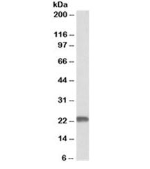 Western blot testing of human cerebellum lysate with MNSOD antibody at 0.01ug/ml. Predicted molecula