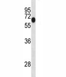 Dyrk1b antibody western blot analysis in mouse lung tissue lysate. Predicted molecular weight: 69/75