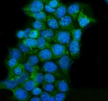 Immunofluorescent staining of FFPE human MCF7 cells with CLPP antibody (green) and DAPI nuclear stai