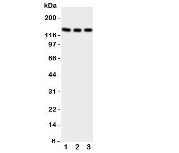Western blot testing of TRKC antibody on Lane 1: rat brain; 2: mouse brain; 3: human U87 cell lysate
