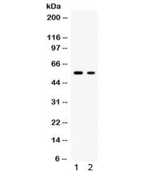GLUT5 Antibody / SLC2A5