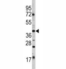 Western blot analysis of Oct-4 antibody and HL-60 lysate. Predicted molecular weight ~38/30kDa (isof