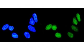 Immunofluorescent staining of FFPE human HeLa cells with RAB9 antibody (green) and DAPI nuclear stai