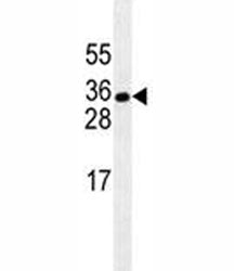 HuR antibody western blot analysis in Jurkat lysate