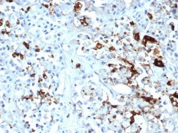 IHC staining of FFPE human pituitary tissue with Prolactin antibody (clone PRL/4908R). HIER: boil ti