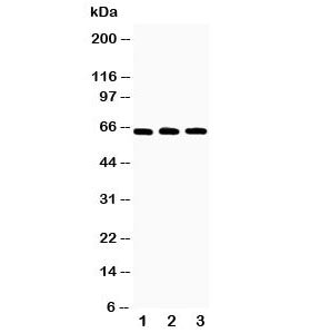 Western blot testing of RANK antibody and Lane 1: recombinant human protein 10ng; 2: 5ng; 3: 2.5ng